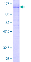 KF1 / RNF103 Protein - 12.5% SDS-PAGE of human RNF103 stained with Coomassie Blue