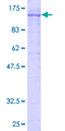 KF1 / RNF103 Protein - 12.5% SDS-PAGE of human RNF103 stained with Coomassie Blue