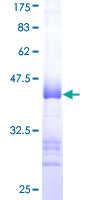 KF1 / RNF103 Protein - 12.5% SDS-PAGE Stained with Coomassie Blue