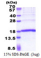 KHDC1L Protein
