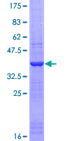 KHDRBS1 / SAM68 Protein - 12.5% SDS-PAGE Stained with Coomassie Blue.