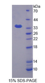 KHDRBS1 / SAM68 Protein - Recombinant KH Domain Containing, RNA Binding, Signal Transduction Associated Protein 1 By SDS-PAGE
