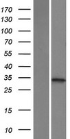 KHK / Ketohexokinase Protein - Western validation with an anti-DDK antibody * L: Control HEK293 lysate R: Over-expression lysate