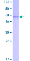 KHK / Ketohexokinase Protein - 12.5% SDS-PAGE of human KHK stained with Coomassie Blue