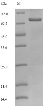 KHK / Ketohexokinase Protein - (Tris-Glycine gel) Discontinuous SDS-PAGE (reduced) with 5% enrichment gel and 15% separation gel.