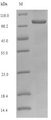 KHK / Ketohexokinase Protein - (Tris-Glycine gel) Discontinuous SDS-PAGE (reduced) with 5% enrichment gel and 15% separation gel.