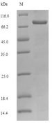 KHK / Ketohexokinase Protein - (Tris-Glycine gel) Discontinuous SDS-PAGE (reduced) with 5% enrichment gel and 15% separation gel.