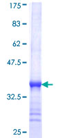 KHK / Ketohexokinase Protein - 12.5% SDS-PAGE Stained with Coomassie Blue.