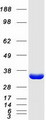 KHK / Ketohexokinase Protein - Purified recombinant protein KHK was analyzed by SDS-PAGE gel and Coomassie Blue Staining