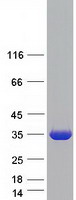 KHK / Ketohexokinase Protein - Purified recombinant protein KHK was analyzed by SDS-PAGE gel and Coomassie Blue Staining