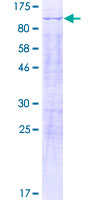 KHNYN Protein - 12.5% SDS-PAGE of human KIAA0323 stained with Coomassie Blue