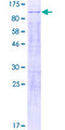 KHNYN Protein - 12.5% SDS-PAGE of human KIAA0323 stained with Coomassie Blue