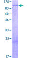 KIAA0020 / PEN Protein - 12.5% SDS-PAGE of human KIAA0020 stained with Coomassie Blue