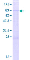 KIAA0141 Protein - 12.5% SDS-PAGE of human KIAA0141 stained with Coomassie Blue