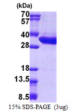 KIAA0152 / MLEC Protein