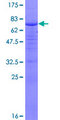 KIAA0191 / ZCCHC11 Protein - 12.5% SDS-PAGE of human ZCCHC11 stained with Coomassie Blue