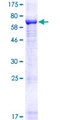 KIAA0226 / RUBICON Protein - 12.5% SDS-PAGE of human KIAA0226 stained with Coomassie Blue