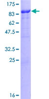 KIAA0226L Protein - 12.5% SDS-PAGE of human C13orf18 stained with Coomassie Blue