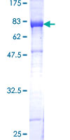 KIAA0368 / ECM29 Protein - 12.5% SDS-PAGE of human KIAA0368 stained with Coomassie Blue