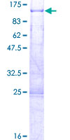 KIAA0427 / CTIF Protein - 12.5% SDS-PAGE of human KIAA0427 stained with Coomassie Blue