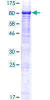 KIAA0467 / SZT2 Protein - 12.5% SDS-PAGE of human KIAA0467 stained with Coomassie Blue