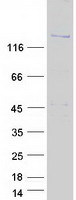 KIAA0476 / DENND4B Protein - Purified recombinant protein DENND4B was analyzed by SDS-PAGE gel and Coomassie Blue Staining