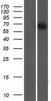 KIAA0828 / AHCYL2 Protein - Western validation with an anti-DDK antibody * L: Control HEK293 lysate R: Over-expression lysate