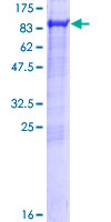 KIAA0828 / AHCYL2 Protein - 12.5% SDS-PAGE of human KIAA0828 stained with Coomassie Blue