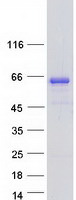 KIAA0828 / AHCYL2 Protein - Purified recombinant protein AHCYL2 was analyzed by SDS-PAGE gel and Coomassie Blue Staining