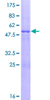 KIAA1109 / FSA Protein - 12.5% SDS-PAGE of human KIAA1109 stained with Coomassie Blue