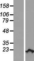 KIAA1143 Protein - Western validation with an anti-DDK antibody * L: Control HEK293 lysate R: Over-expression lysate