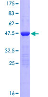 KIAA1143 Protein - 12.5% SDS-PAGE of human KIAA1143 stained with Coomassie Blue