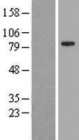 KIAA1161 Protein - Western validation with an anti-DDK antibody * L: Control HEK293 lysate R: Over-expression lysate