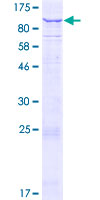 KIAA1161 Protein - 12.5% SDS-PAGE of human KIAA1161 stained with Coomassie Blue