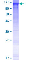 KIAA1217 Protein - 12.5% SDS-PAGE of human KIAA1217 stained with Coomassie Blue