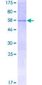 KIAA1236 / KIF26A Protein - 12.5% SDS-PAGE of human KIF26A stained with Coomassie Blue