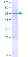KIAA1257 Protein - 12.5% SDS-PAGE of human KIAA1257 stained with Coomassie Blue
