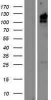 KIAA1324L Protein - Western validation with an anti-DDK antibody * L: Control HEK293 lysate R: Over-expression lysate