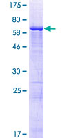 KIAA1456 / C8orf79 Protein - 12.5% SDS-PAGE of human C8orf79 stained with Coomassie Blue
