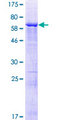 KIAA1456 / C8orf79 Protein - 12.5% SDS-PAGE of human C8orf79 stained with Coomassie Blue