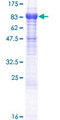 KIAA1467 Protein - 12.5% SDS-PAGE of human KIAA1467 stained with Coomassie Blue