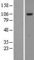 KIAA1524 / p90 Autoantigen Protein - Western validation with an anti-DDK antibody * L: Control HEK293 lysate R: Over-expression lysate