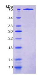 KIAA1524 / p90 Autoantigen Protein - Recombinant  Cancerous Inhibitor Of PP2A By SDS-PAGE