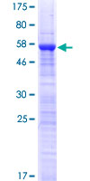 KIAA1530 Protein - 12.5% SDS-PAGE of human KIAA1530 stained with Coomassie Blue