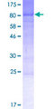 KIAA1539 Protein - 12.5% SDS-PAGE of human KIAA1539 stained with Coomassie Blue