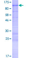 KIAA1586 Protein - 12.5% SDS-PAGE of human KIAA1586 stained with Coomassie Blue