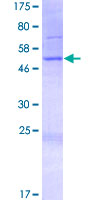KIAA1641 Protein - 12.5% SDS-PAGE of human ANKRD36B stained with Coomassie Blue