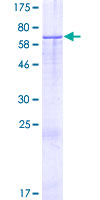 KIAA1683 Protein - 12.5% SDS-PAGE of human KIAA1683 stained with Coomassie Blue