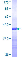 KIAA1811 / BRSK1 Protein - 12.5% SDS-PAGE Stained with Coomassie Blue.