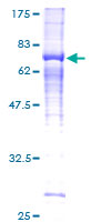 KIAA1840 / SPG11 Protein - 12.5% SDS-PAGE of human SPG11 stained with Coomassie Blue